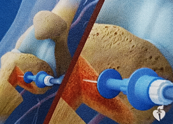 ■Significant Changes