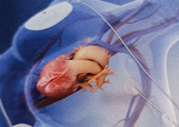 ■Significant Changes